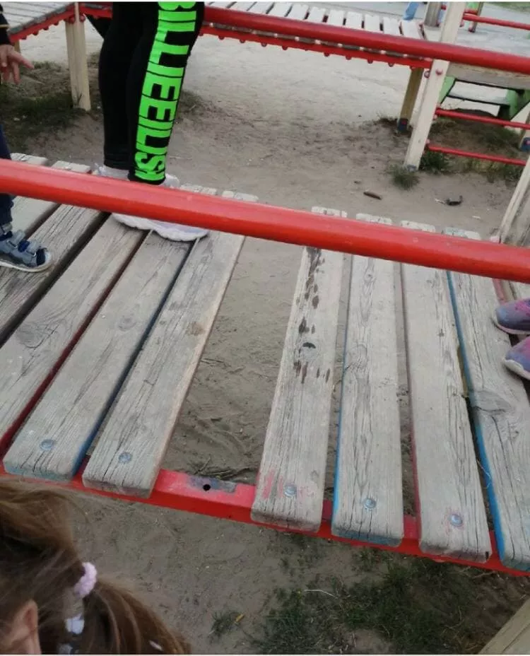 В Копейске малышка травмировалась во время игры в сквере