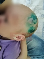 В больнице Челябинска мать укусила за голову двухмесячного ребенка