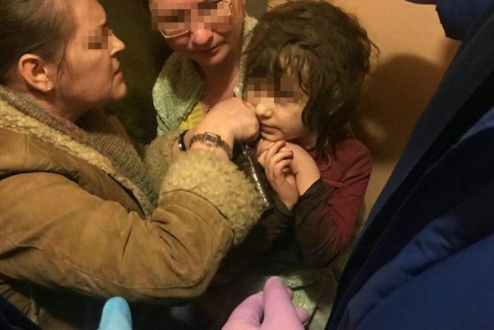 В Москве спасли 5-летнюю «маугли» с вросшей в шею цепочкой