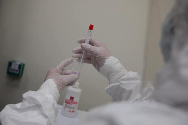 Представители минздрава рассказали о причинах вспышки коронавируса в онкоцентре