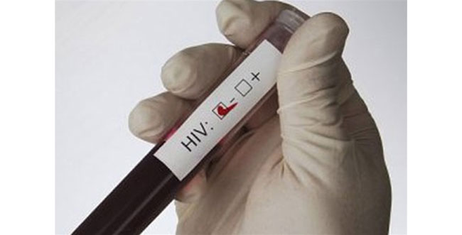 Тест на ВИЧ